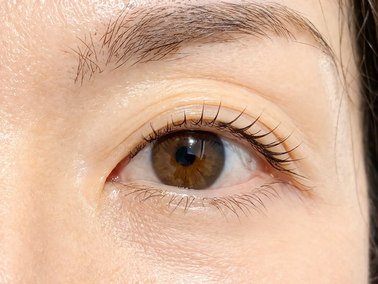 マイラミネーションにデメリットはある?